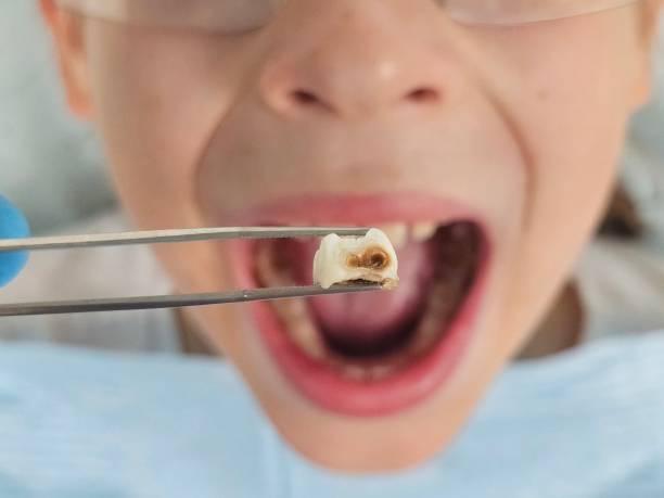 Best Weekend Emergency Dentist in Edgecliff Village, TX